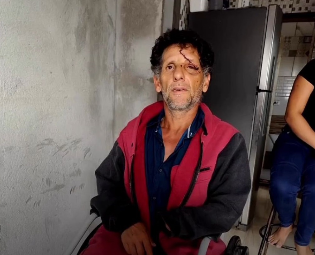Autônomo está sem conseguir trabalhar devido ao ocorrido (Foto: Arquivo pessoal)